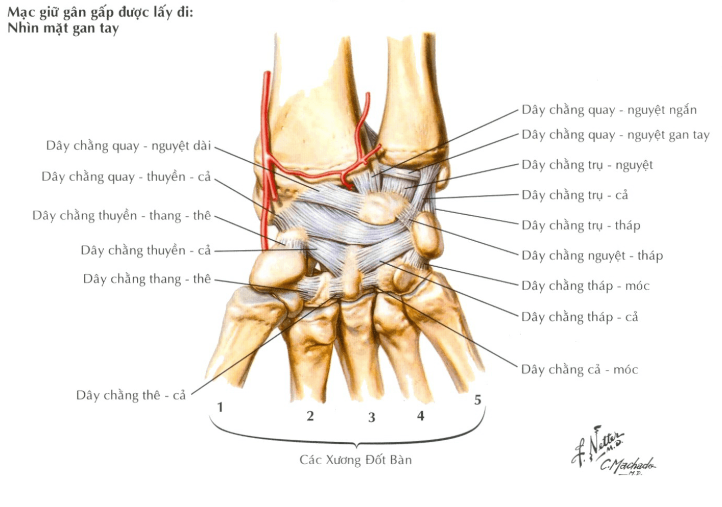 Dây chằng ngoại lai cổ tay